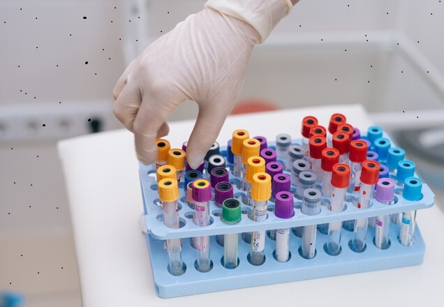 Blood Collection Tubes for Liquid Biopsy Market Overview and Forecast Analysis Up To 2028