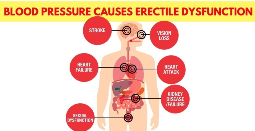 Blood-Pressure causes Erectile Dysfunction
