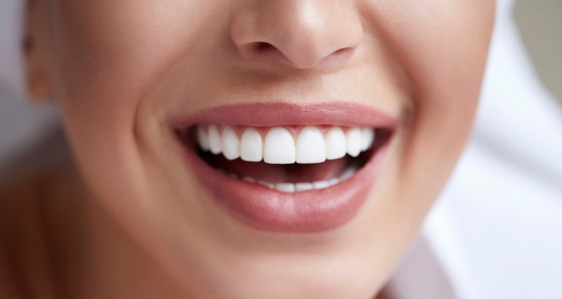 Orthodontist: The Key to a Perfect Smile
